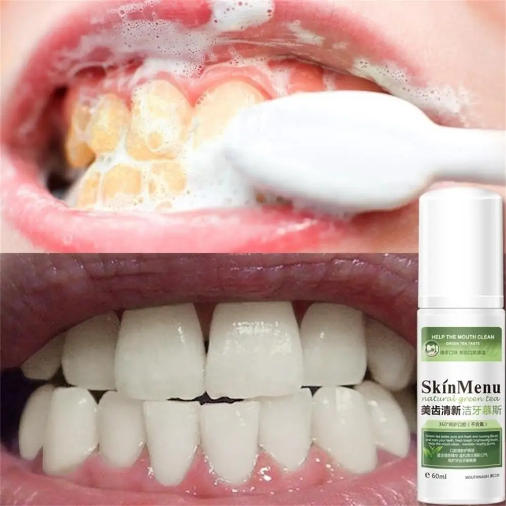 Мусс для чистки зубов свежий тон рандомное средство устранения неприятного