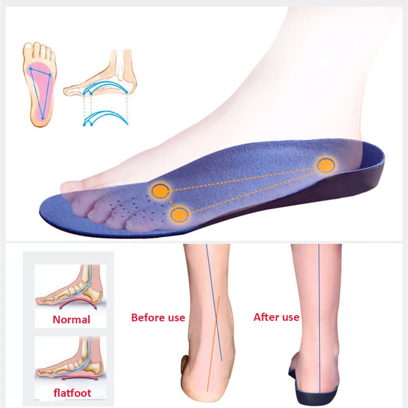 1 pair Unisex EVA Adult Flat Foot Orthopedic Insoles Arch Support Orthopedic Insole for Men Women Feet Health Care pad size35-48 1 pair flat feet arch support insole silica orthotics superier breathable latex leather insole foot pad