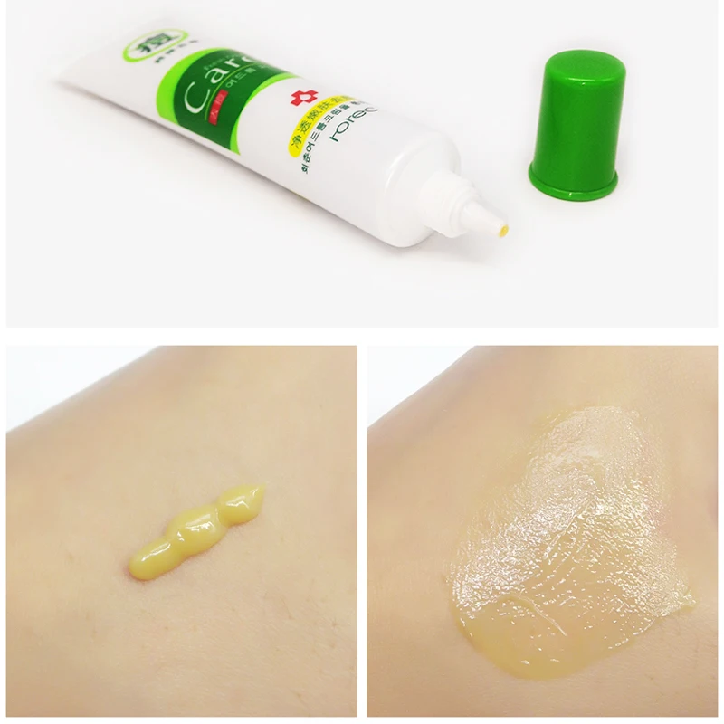 ROREC 30 г крем для лица лечение акне увлажнение уход за кожей средство удаления