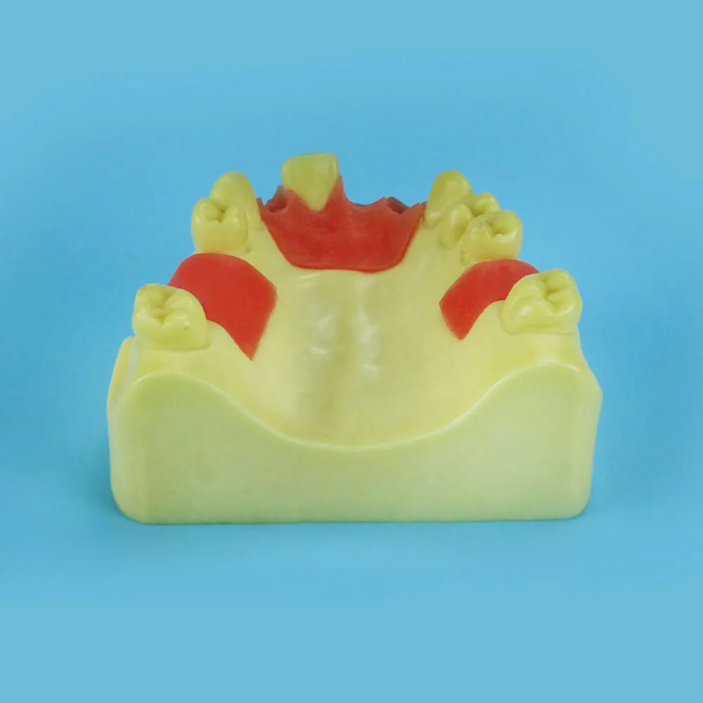 

Oral model, maxillary anterior missing implant practice model, dental implant model