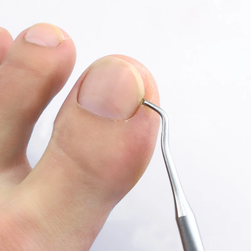 

Ingrown Toe Nail Correction Lifter Nail File Clean Installation Tool Pedicure Foot Nail Care Hook Cleaner Double Sided