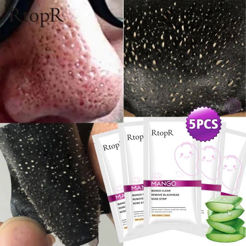 5 шт./партия маска для удаления угрей очищения пор черная пилинг акне лица масло