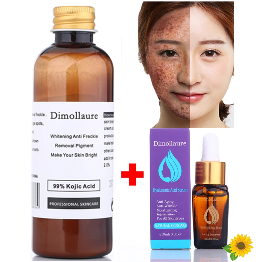 Hyaluronic acid Dimollaure 30 г чистая койевая кислота отбеливающий крем+ койевая кислота Сыворотка от морщин удаление веснушек меласма акне шрам пигмент крем с меланином - Цвет: Hyaluronic acid
