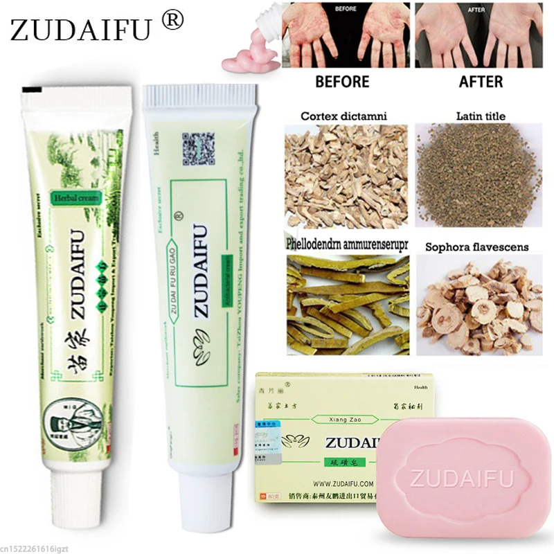 Zudaifu псориаз крем от псориаза мазь дерматит Eczematoid Eczema мазь лечение кожи крем
