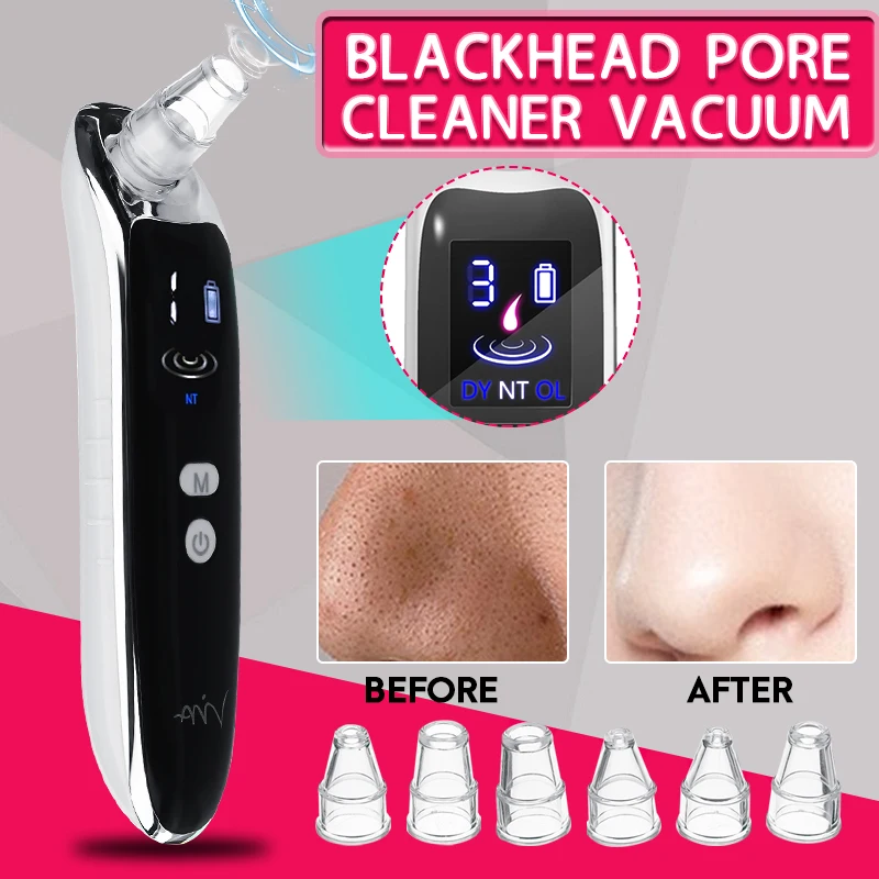 Black 7 in 1 Set Инструменты для очищения пор и ухода за кожей, электрический беспроводной вакуумный прибор для удаления черных точек, очиститель акне, электрический прибор для удаления пор с зарядкой - Цвет: Black 7 in 1 Set