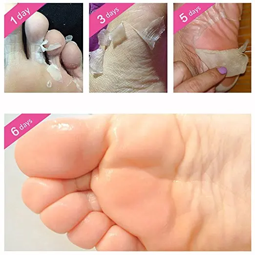 No Salicylic кислота питает отшелушиватель маска для ног пятка Уход за ногами пилинг кутикул отбеливание каллус твердый мертвый Бережный уход за кожей