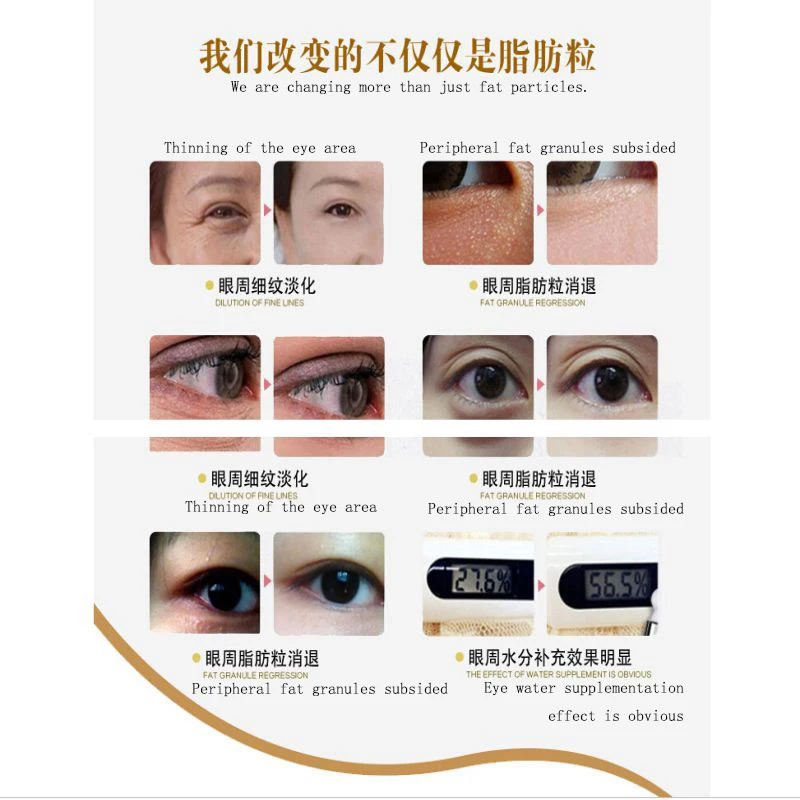 Гиалуроновая кислота эссенция глаз против морщин для удаления жира темные круги