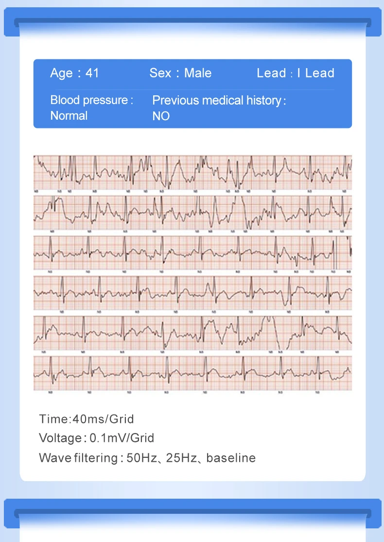 H66plus браслет для измерения артериального давления пульсометр PPG ECG Смарт