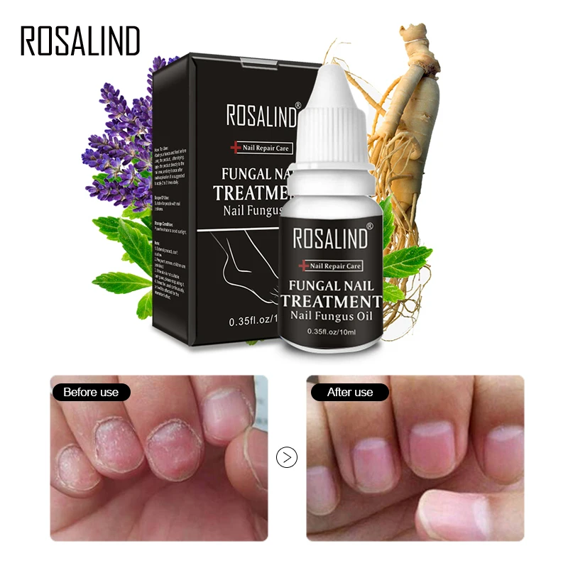 ROSALIND масло для ухода за ногтями грибка 1 шт. восстанавливает лак ногтей устраняет