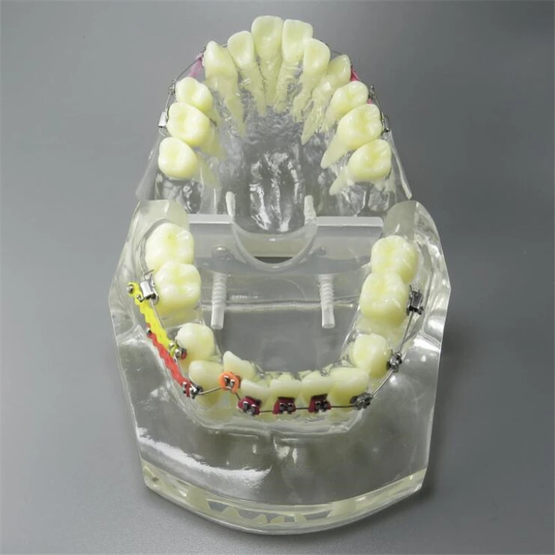 1 шт. прозрачный Зуб модель зубы Malocclusion Ортодонтическая красочная модель Стоматологическое исследование стоматолога обучение