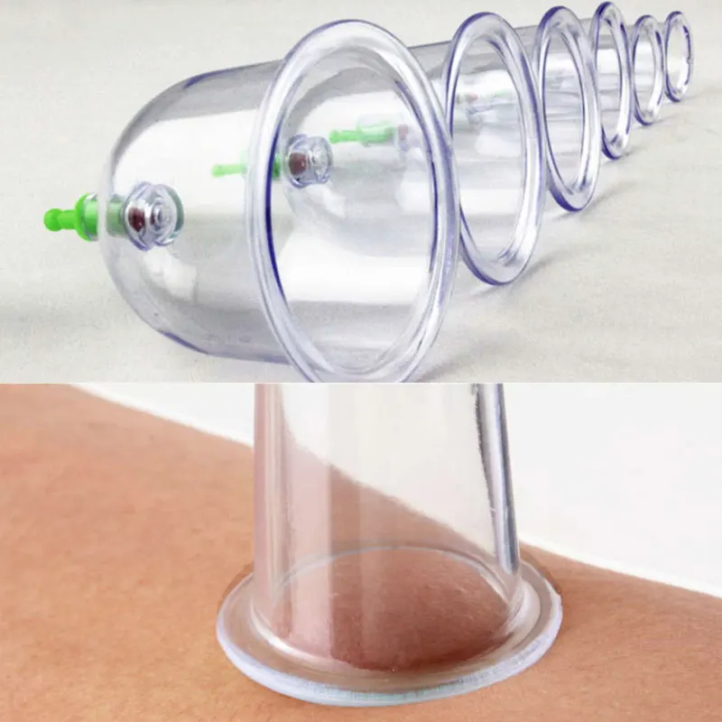 6 шт. набор кипирования Китайский Вакуумный баночный аппарат массаж тела