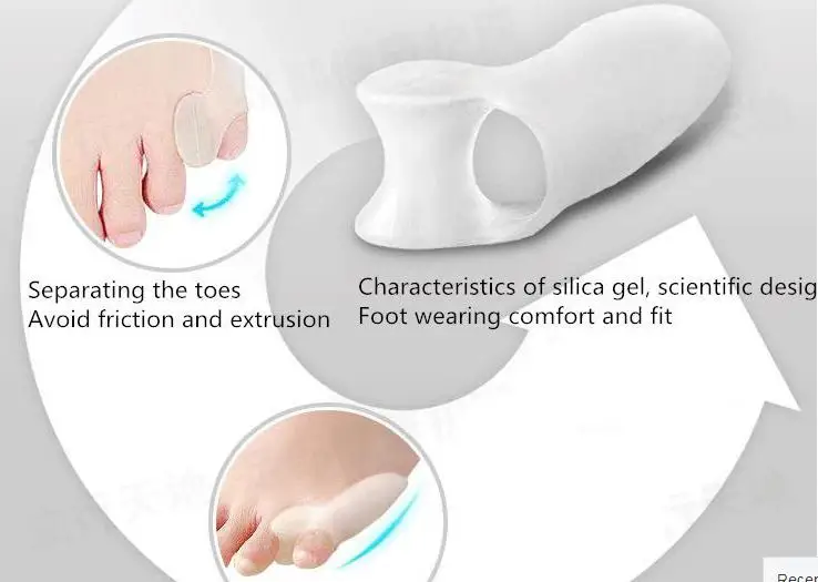 Скобы и поддержка гелевого разделителя большого пальца ноги облегчает боль в