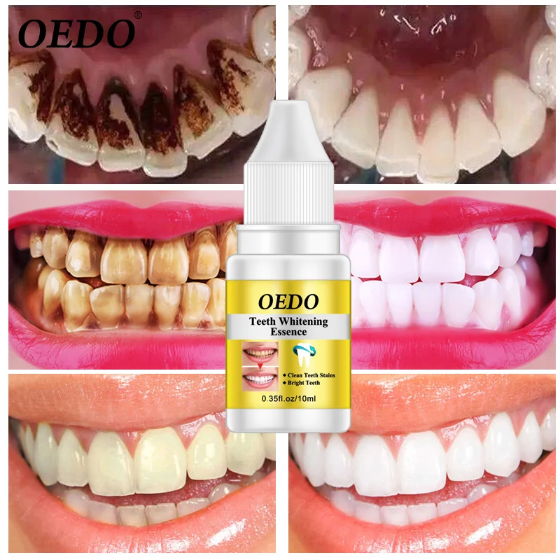 Белые зубы зубные Dientes Dentes Brancos Dente отбеливание улыбка ослепительный отбеливатель