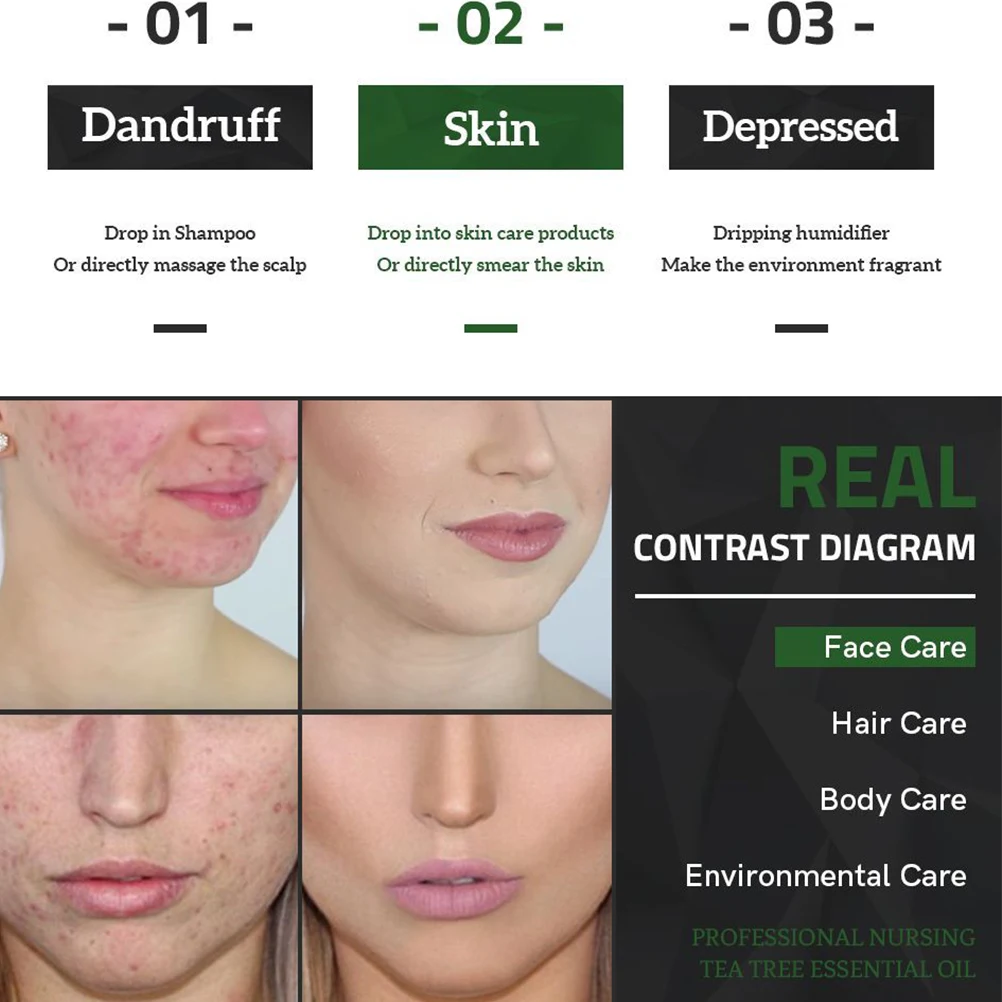 Antibacterial Anti-inflammatory Tea Tree Oil Moisturizing Essential for Blemished Skin Anti-pimples Warts Fungus |