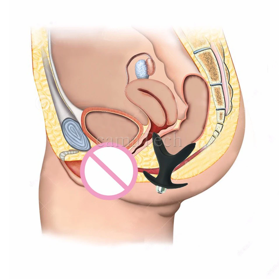 CamaTech мягкий силиконовый игрушки для взрослых Plug V Порты и разъёмы расширитель