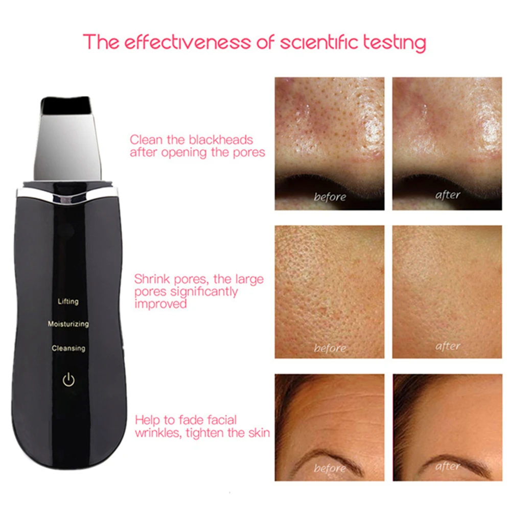 Инструмент для ухода за лицом Ультразвуковой ионный скребок лица пилинг пор и
