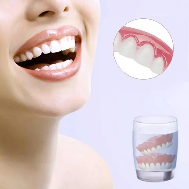 Smile комфорт верхние зубы шпон косметический | Красота и здоровье