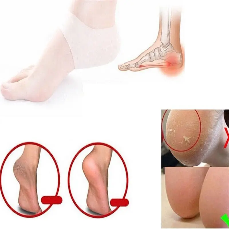 Новые силиконовые Увлажняющие гелевые носки для пятки с трещинами ухода за кожей