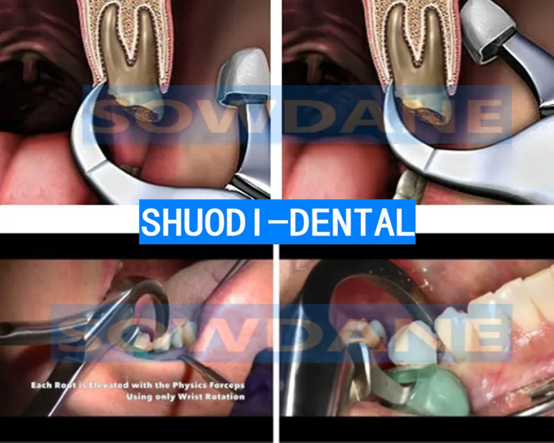 4 шт./компл. новые взрослые стоматологические экстракционные щипцы из
