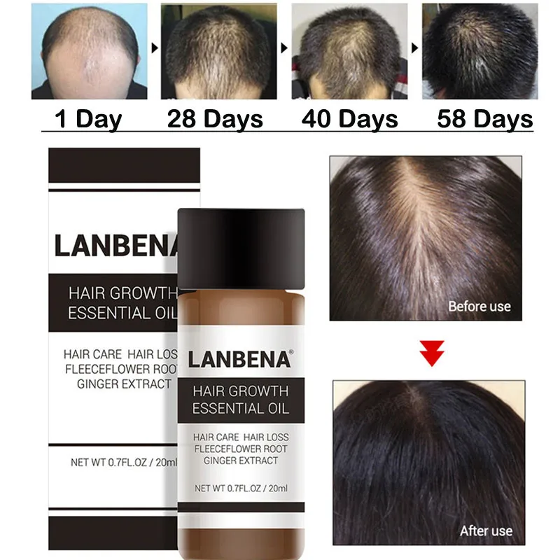 Эссенция LANBENA против выпадения волос быстродействующая эссенция Sunburst для