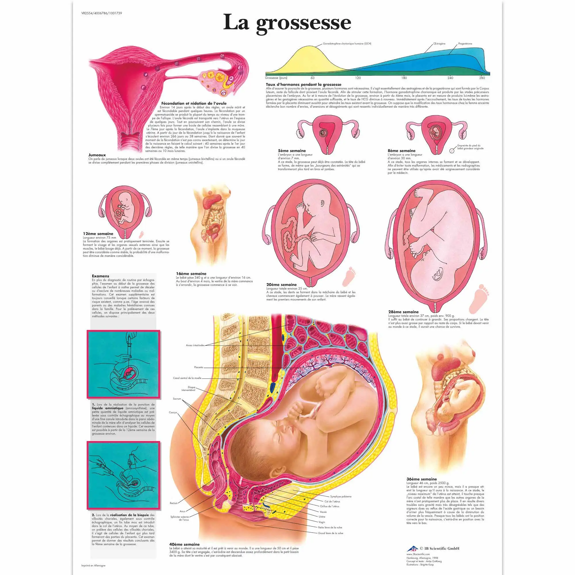 Анатомическая патология анатомический постер La grossesse классический холст картины