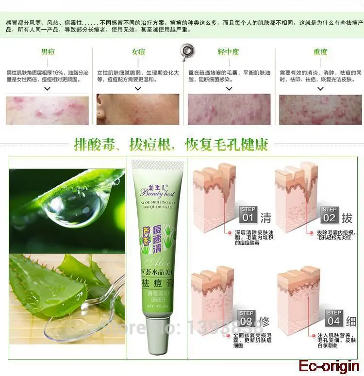 Aloe Acne Vulgaris Scar Whelk Pimple Treatment Remove Vanishing Dispelling Plaster Facial Cream Skin Care