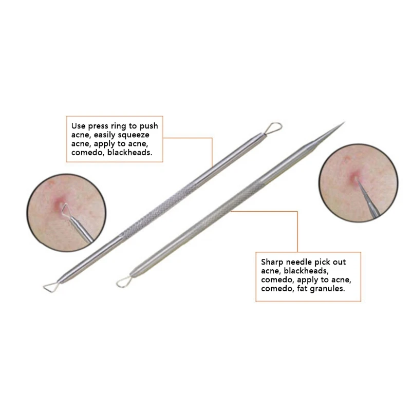 1 шт. экстрактор черных точек из нержавеющей стали | Красота и здоровье