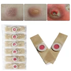 Пластырь для удаления мозолей, медицинский пластырь для снятия мозолей, 612 шт.