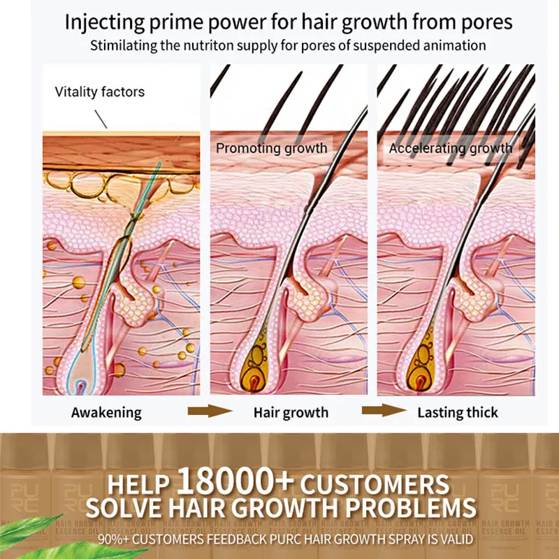 

Pro Fast Growth Hair Grwoth Spray Hair Essence Preventing Hair Loss Essential Oil Liquid Treatment Recommend