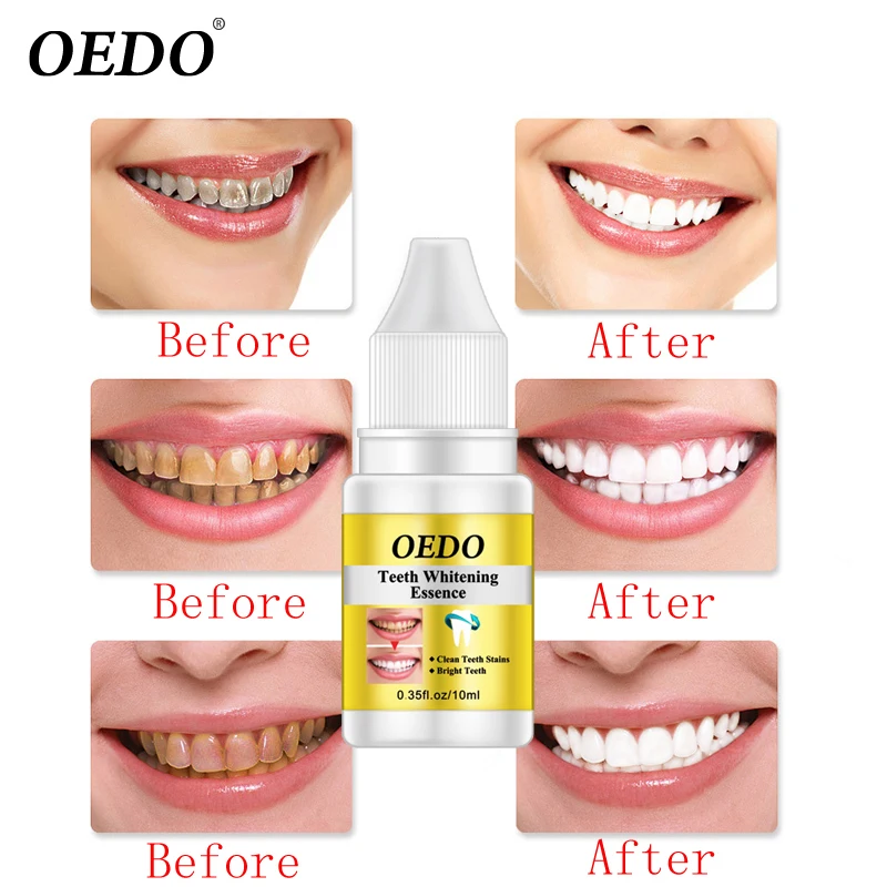 Белые зубы зубные Dientes Dentes Brancos Dente отбеливание улыбка ослепительный отбеливатель