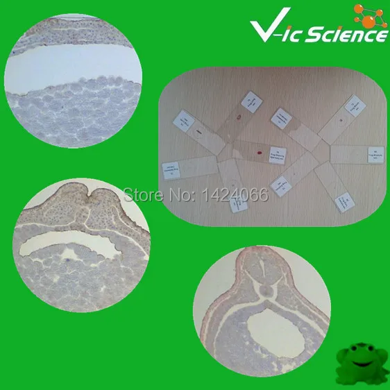 Набор лезвий для эмбриологии | Канцтовары офиса и дома