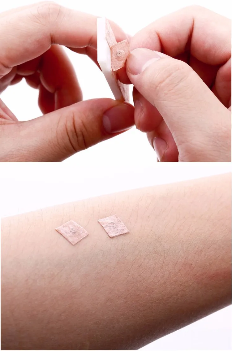 Zhongyantaihe Стерильная игла для подкожной интрадермальной терапии ушного пресса -