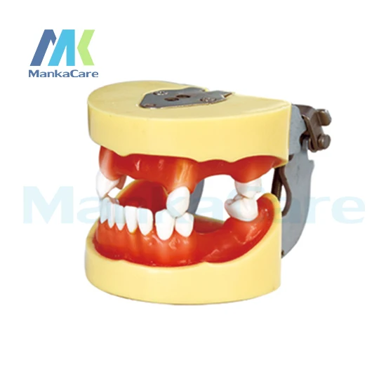 Manka Care - Implant Model Oral Model Teeth Tooth Model