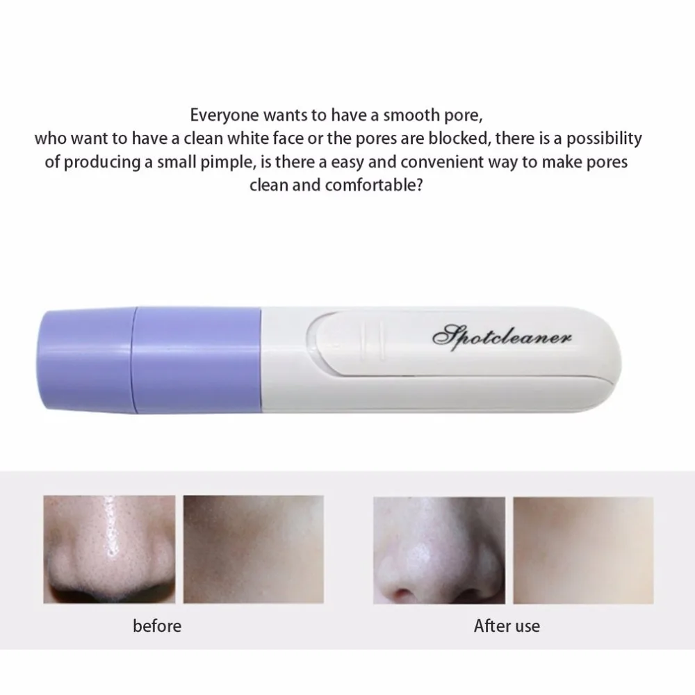 Mini Portable Blackhead Remover Tool Vacuum Extractor Acne Suction Exfoliating Pore Cleanser Beauty Instrument | Красота и здоровье
