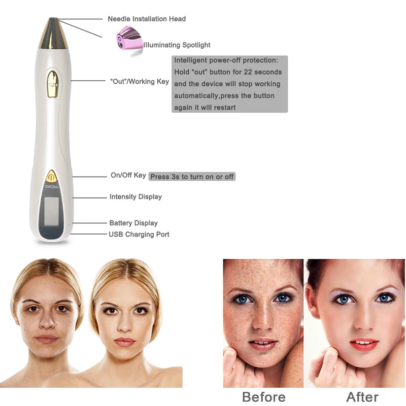 Уход за кожей лица лазерный моль Татуировка карандаш для удаления веснушек ЖК-дисплей Развертки Пятно моль удаление бородавок мозолей темное пятновыводитель красота машина