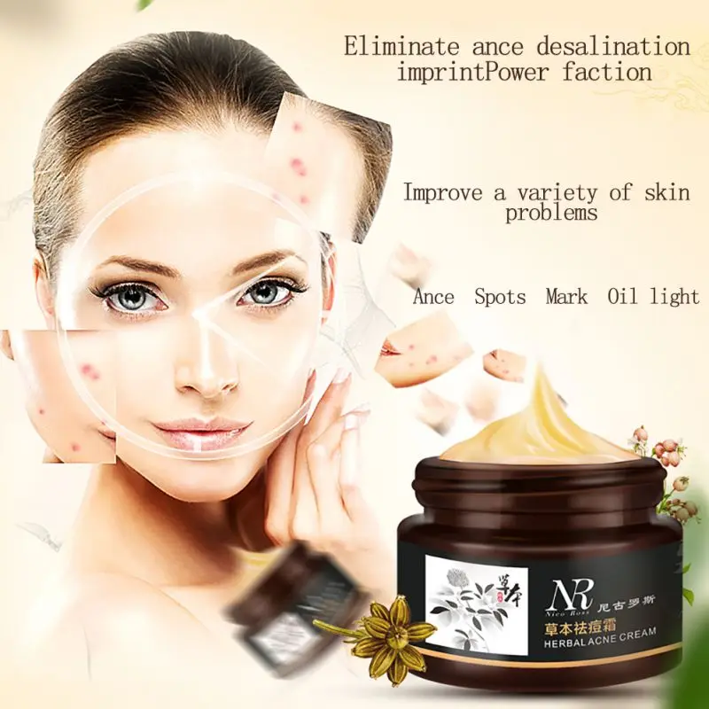 BTG 2018 натуральный травяной увлажняющий крем для ухода за кожей|skin care cream|skin creamfreckles