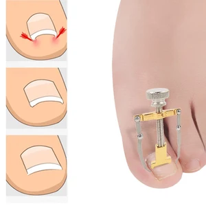 Ingrown Toe Nail Corrector Pedicure Tool for Foot Care Toe Clipper Remover Kit Detox Machine Onyxis Bunion Precision Woman Man