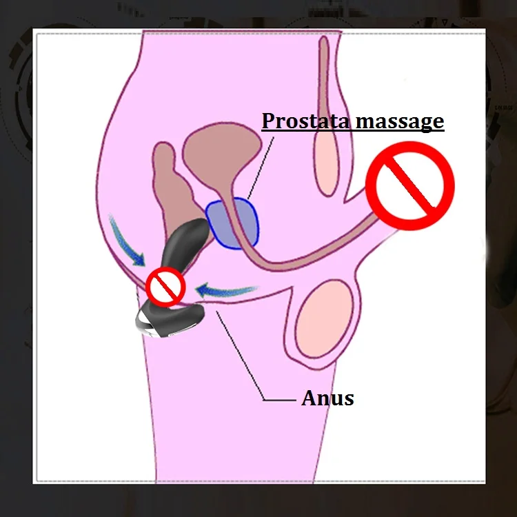 Nalone-XY Silicone/ Metal Butt Plug Wireless Remote Control Vibrator Anal Sex Toys for Men Gay Male Postate Massager |