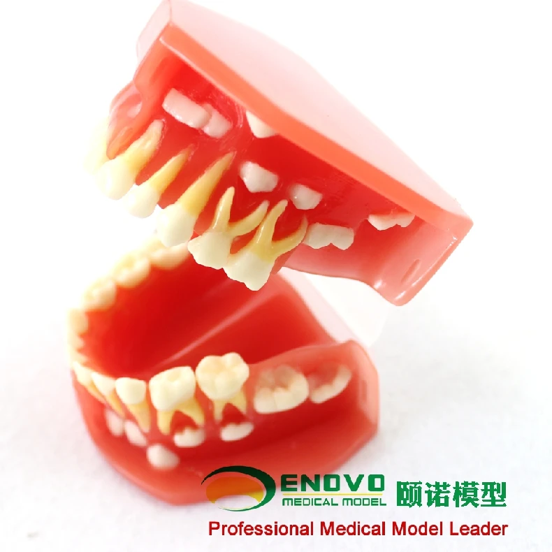 

Dental dentistry model of pediatric dentition