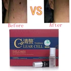 Китайские лекарственные средства для удаления веснушек и морщин