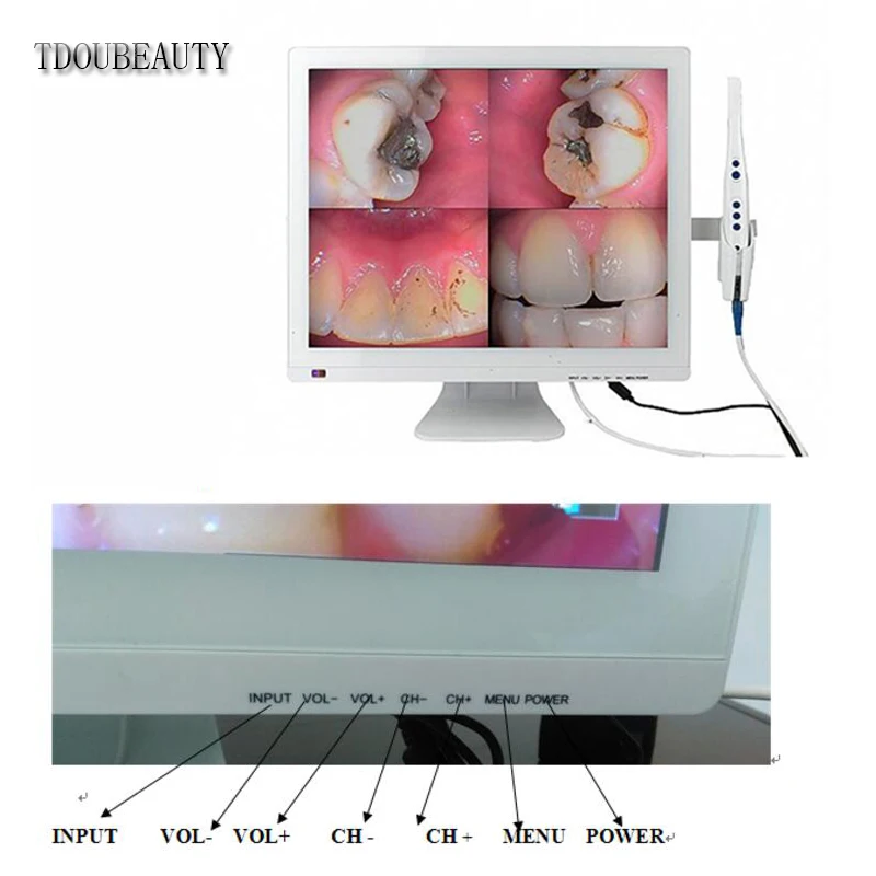 TDOUBEAUTY HD Стоматологическая Интраоральная Камера M 978 (2 в 1)+ автономные 17 дюймовый