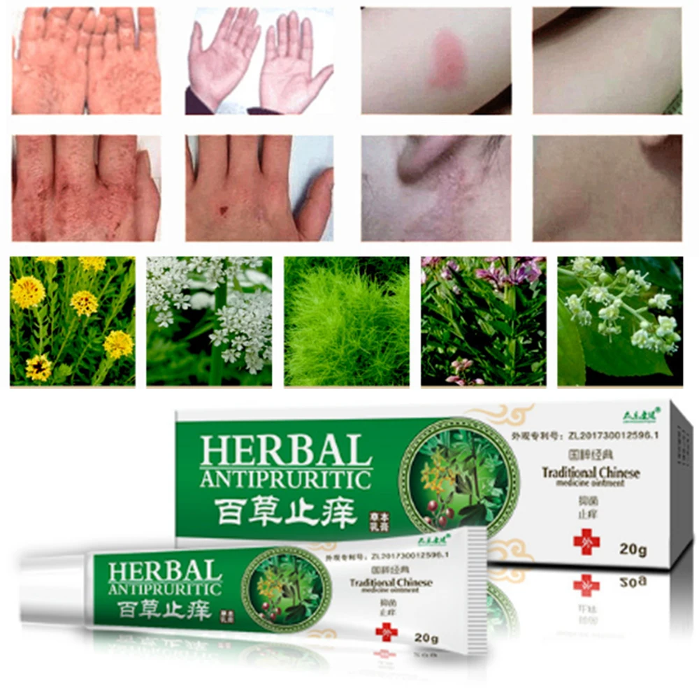 20 г крем от псориаза для дерматита и экземы зуд псориаз травяная мазь кремы