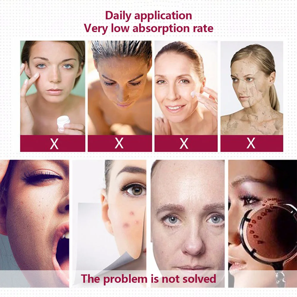 Электрический дермаинг профессиональный беспроводной электрический набор по уходу за кожей микроблейдинг иглы дермаинг тату Пистолет Мезотерапия dr. pen