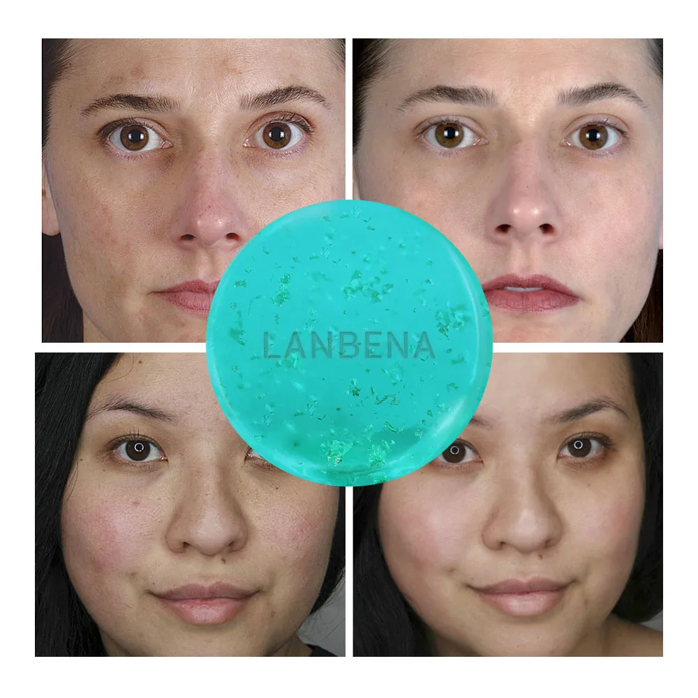 LANBENA 3 модели ручной работы мыло масло от акне Управление Отбеливающее эфирное