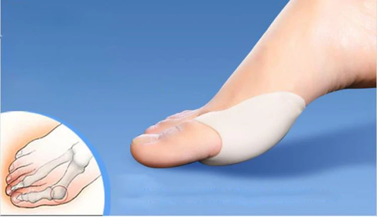 Детский разветвитель большого пальца ноги облегчает выпрямление | Красота и