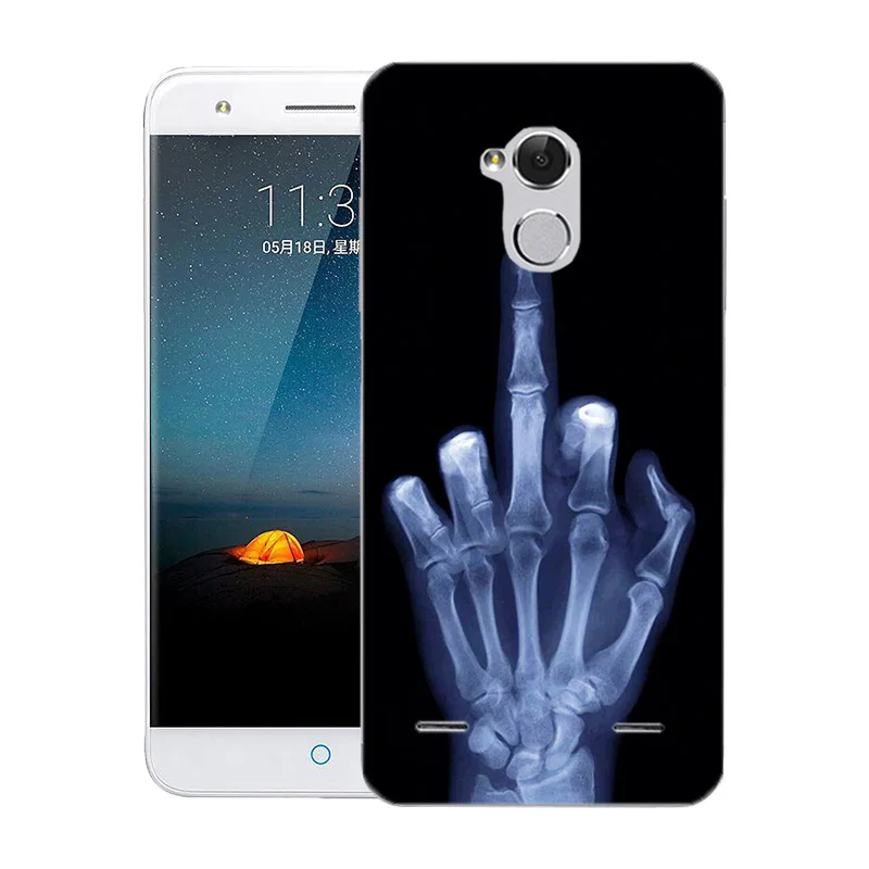 05 ТПУ защитный чехол для htc Desire 628 One M8 M8s U Play Ультра розовый чехол с принтом для zte Blade V7 Lite Axon 7 A2017 Mini чехол - Цвет: 05