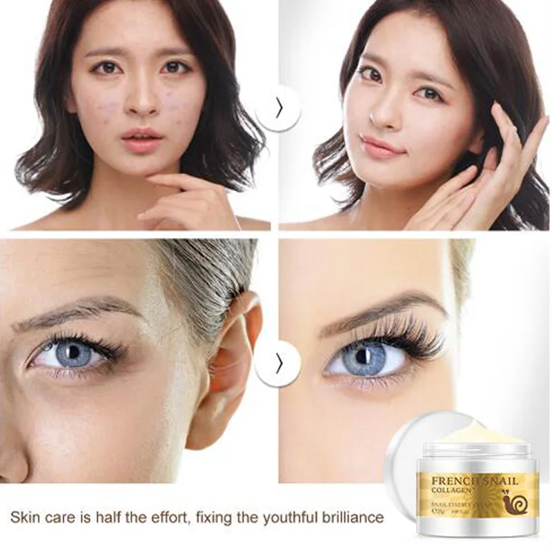 

LAIKOU Snail Face Cream Acne Scar Removal cream For Face Skin Care Whitening Cream Snail Stretch Marks Nourishing For Face