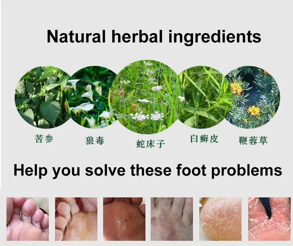 3 шт. дезодорирующий крем от псориаза дерматит экзема знойный запах травяной