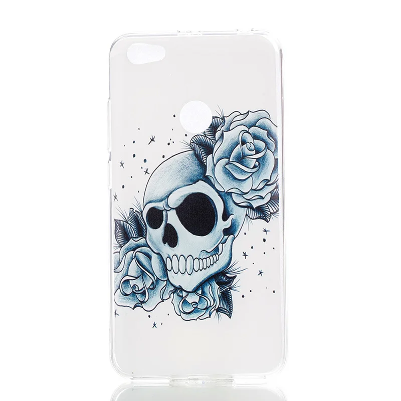 Cute Cat Fashion Flora For Xiaomi Redmi 4 Cases Transparent Silicon TPU Phone Note 5A |