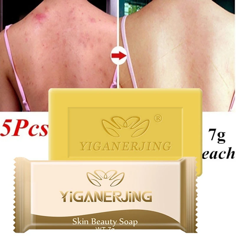 5 шт. мазь из Серного мыла для лечения псориаза дерматита экземы псориаза|Мыло| |